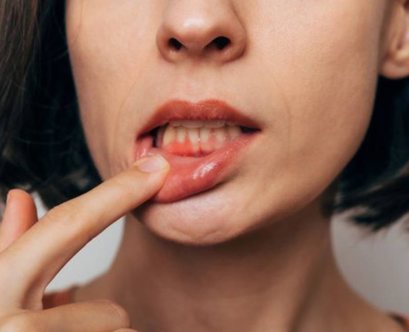 Lady shows inflamed gums