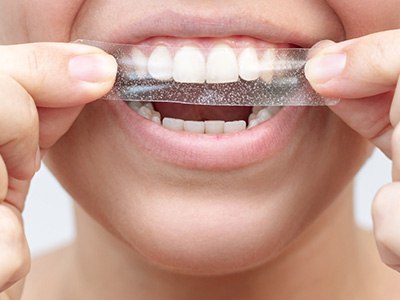 Someone placing whitening strip over upper arch