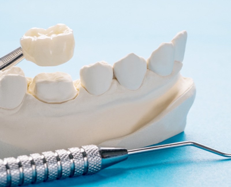 A dental mold and customized dental crown  