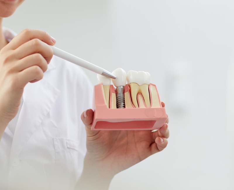 Dentist pointing to dental implant tooth replacement model