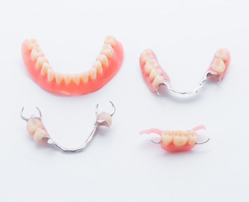 different types of dentures on white background 