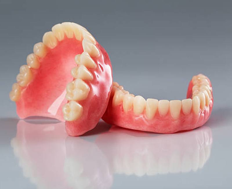 Traditional upper and lower denture