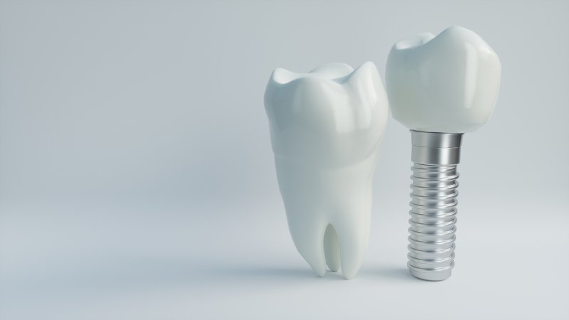 a tooth and dental implant