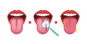 tongue scraper illustration 