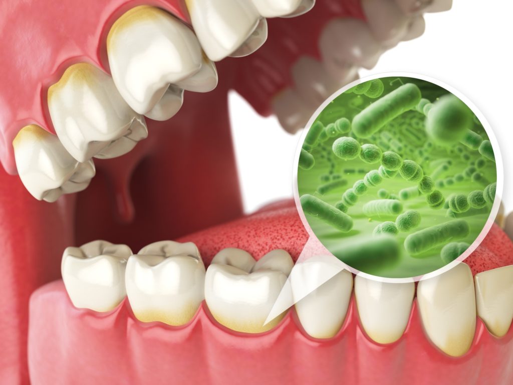 Connection Between and Gum Disease in Rochester